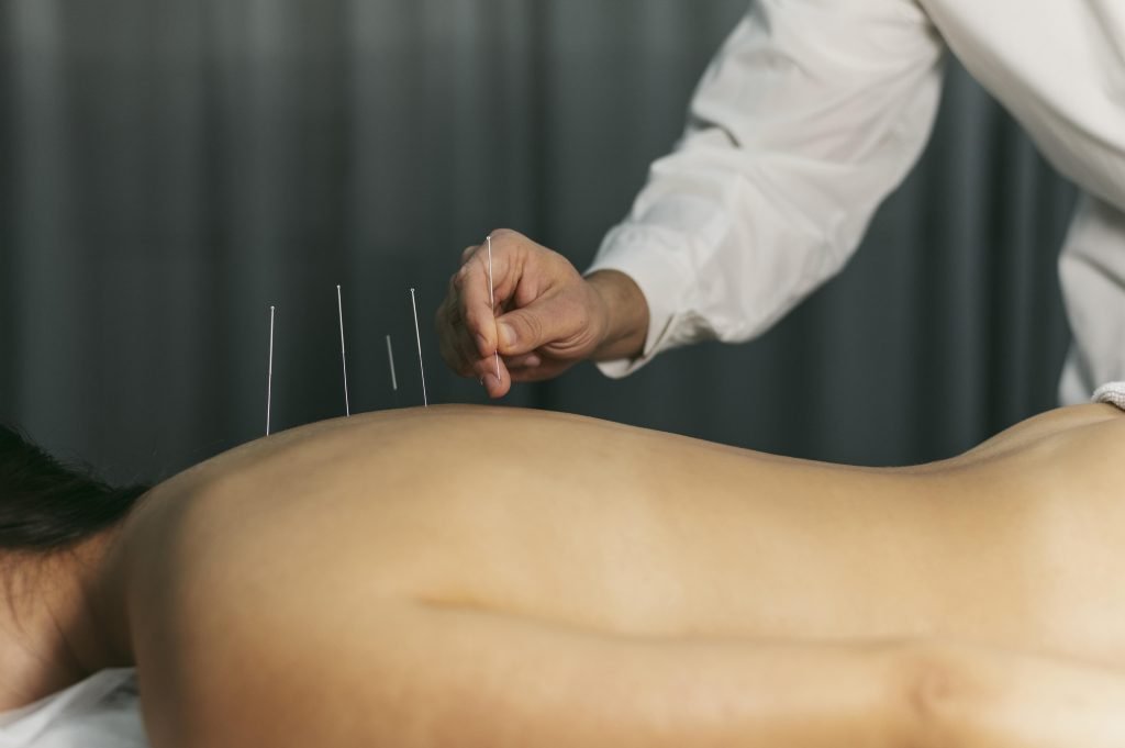 Acupuncturist in Nieuwegein